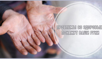 Проблемы со здоровьем покажут ваши руки